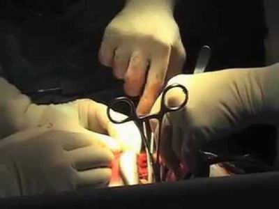 Tiệt trùng nước cho sản xuất rượu bia - Tác hại của rượu bia?